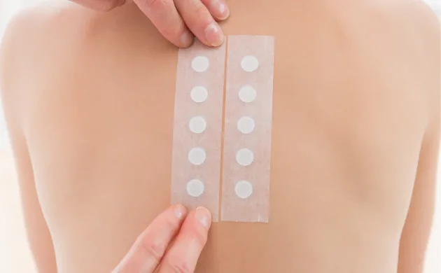 patch test