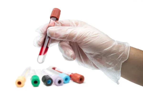 Infermieri a domicilio a Milano: prelievo del sangue a casa